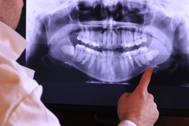 Best Tooth Infection Emergency Dentist  in Holly Hill, FL